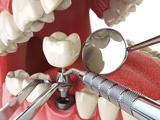 Best Broken or Chipped Tooth Repair in Blaine, TN